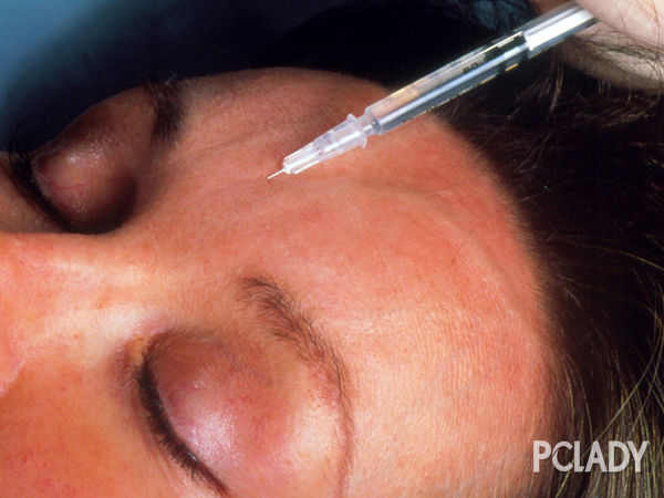 打美白针有什么好处