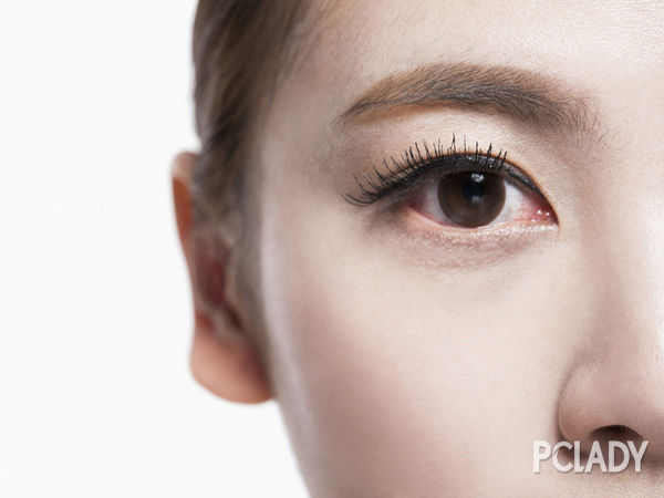 激光去痘印手术价格